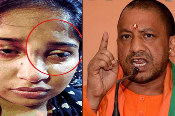 lucknow-police-hit-a-lady-with-stick-two-constable-suspended-on-the-instructions-of-cm-yogi